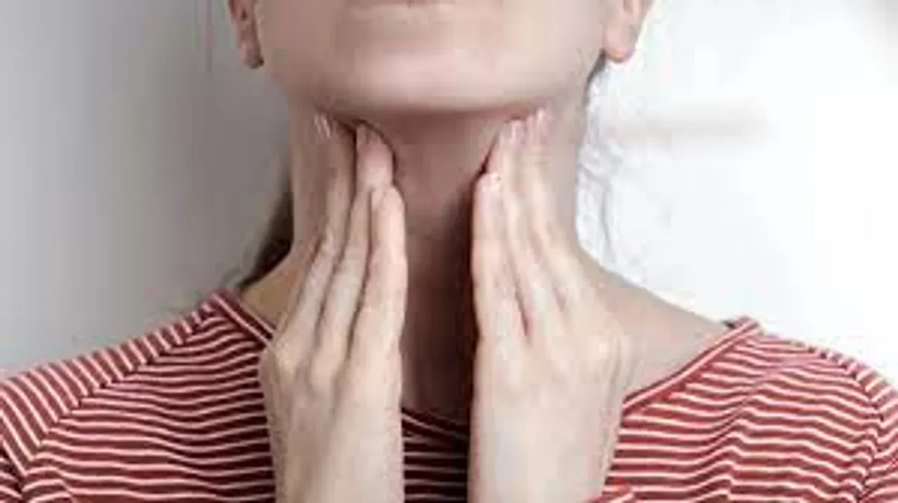 mononucleosis